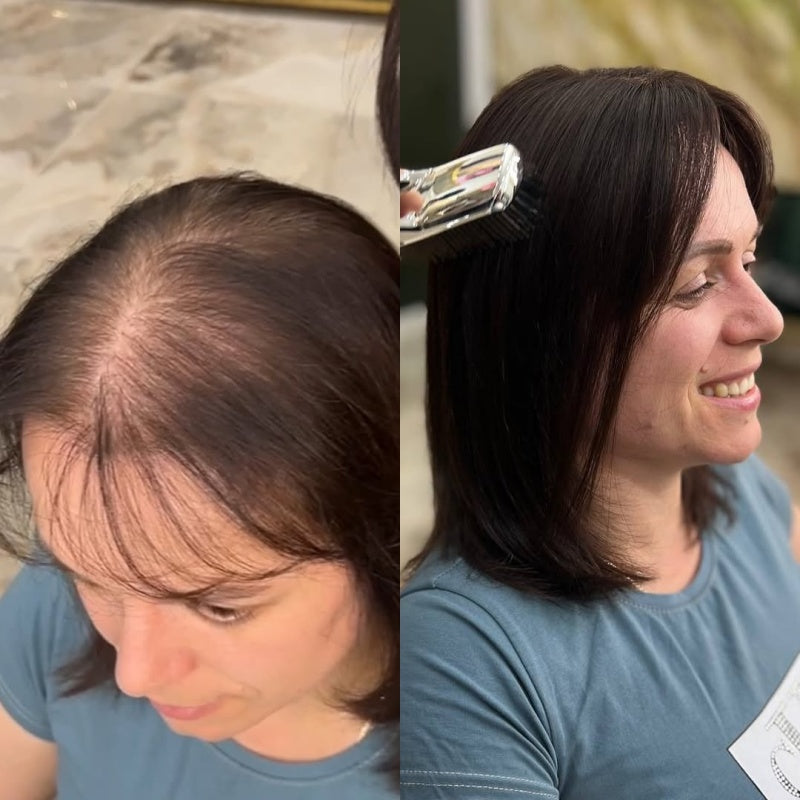 🔥Straight Hair Topper for Crown Thinning – Natural Coverage at the Crown