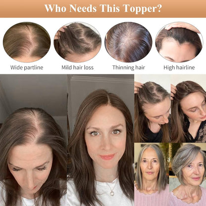 🔥Straight Hair Topper for Crown Thinning – Natural Coverage at the Crown