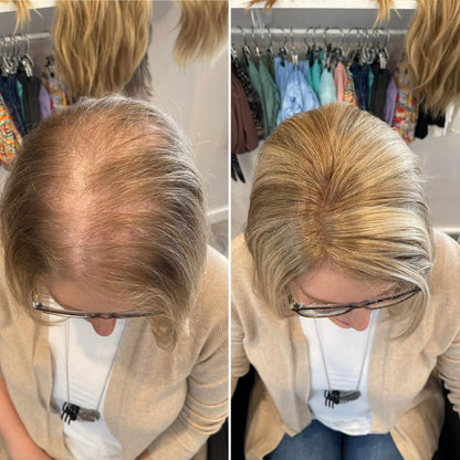 🔥Straight Hair Topper for Crown Thinning – Natural Coverage at the Crown