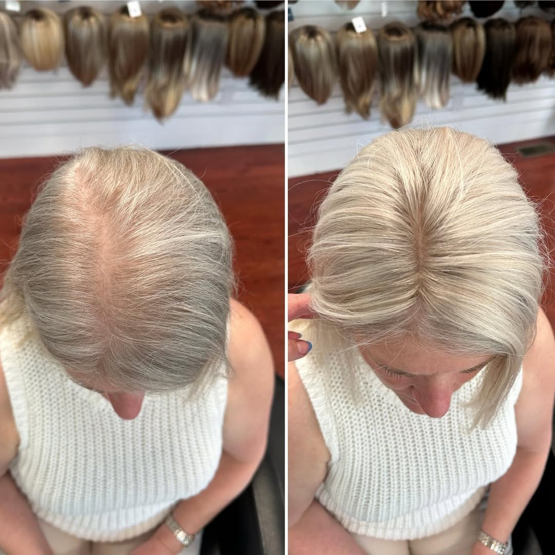 🔥Straight Hair Topper for Crown Thinning – Natural Coverage at the Crown